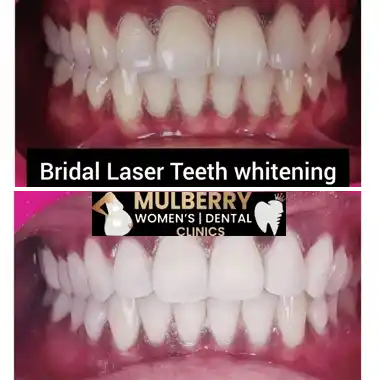 Before After Images