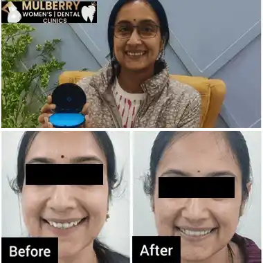Before After Images